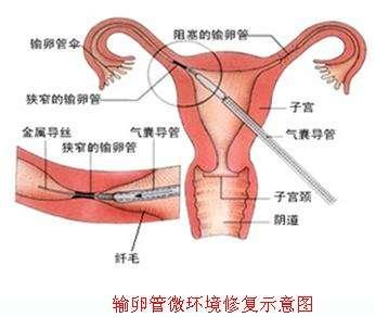 通草的功效与作用能通输卵管堵塞,最新方案解答_网页款39.341